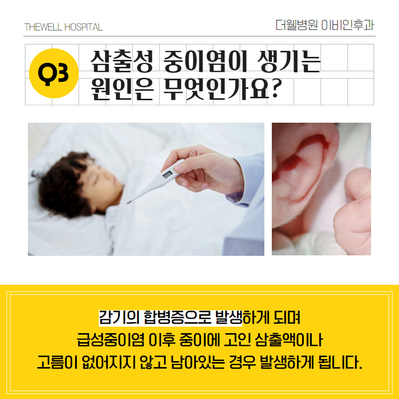 어린이 중이염이 많은 이유는? (4/10)