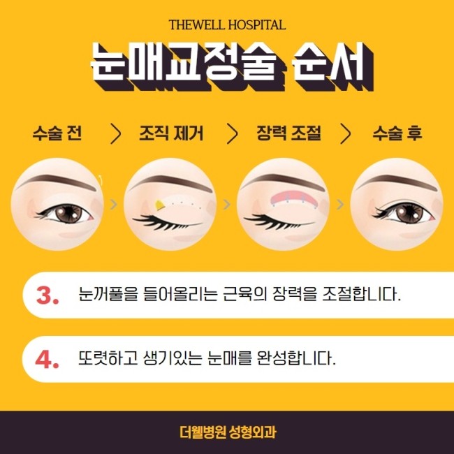 졸리고 처진 눈을 생기있게! (6/11)
