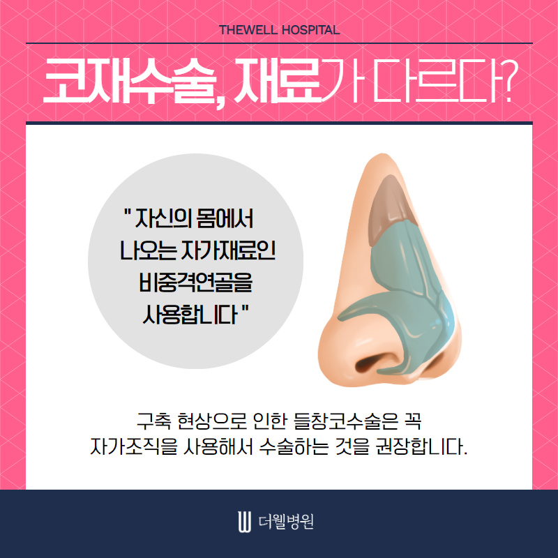 기능과 모양까지 고려해야 성공하는 여성 코재수술 (4/10)