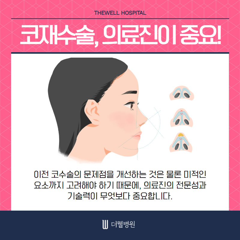 기능과 모양까지 고려해야 성공하는 여성 코재수술 (5/10)