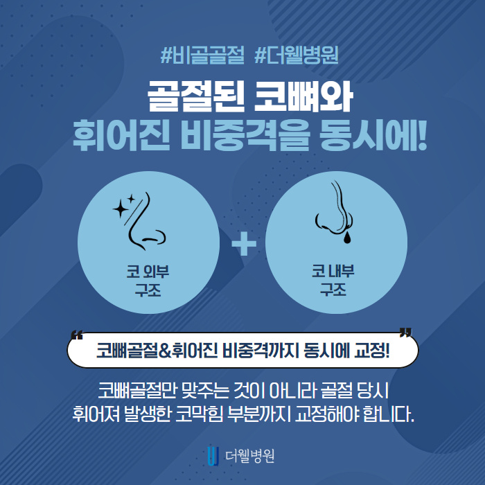 코 뼈가 부러졌다면 신속하게 치료! (6/10)