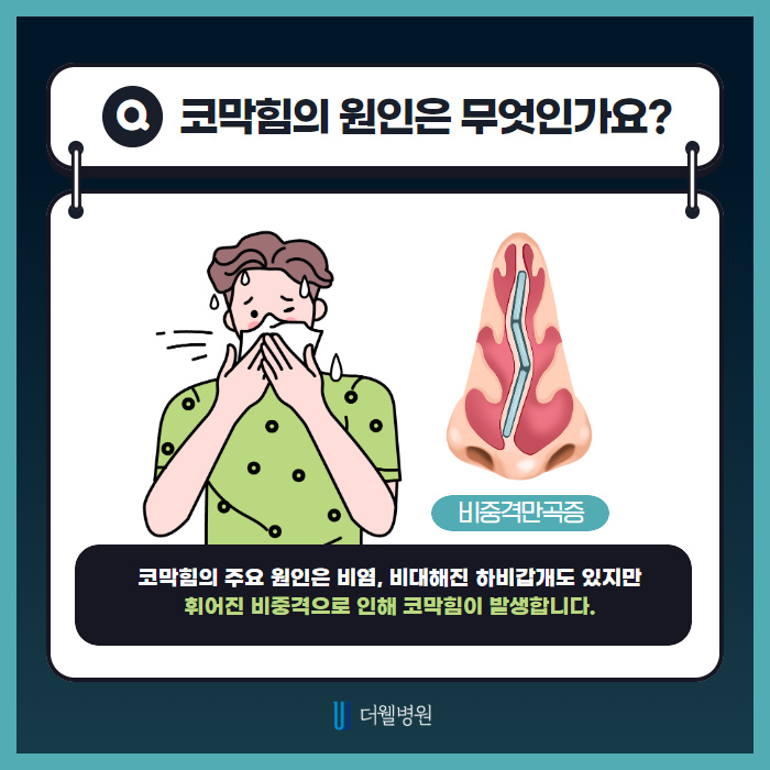 코막힘 이제 날려버려! (2/10)