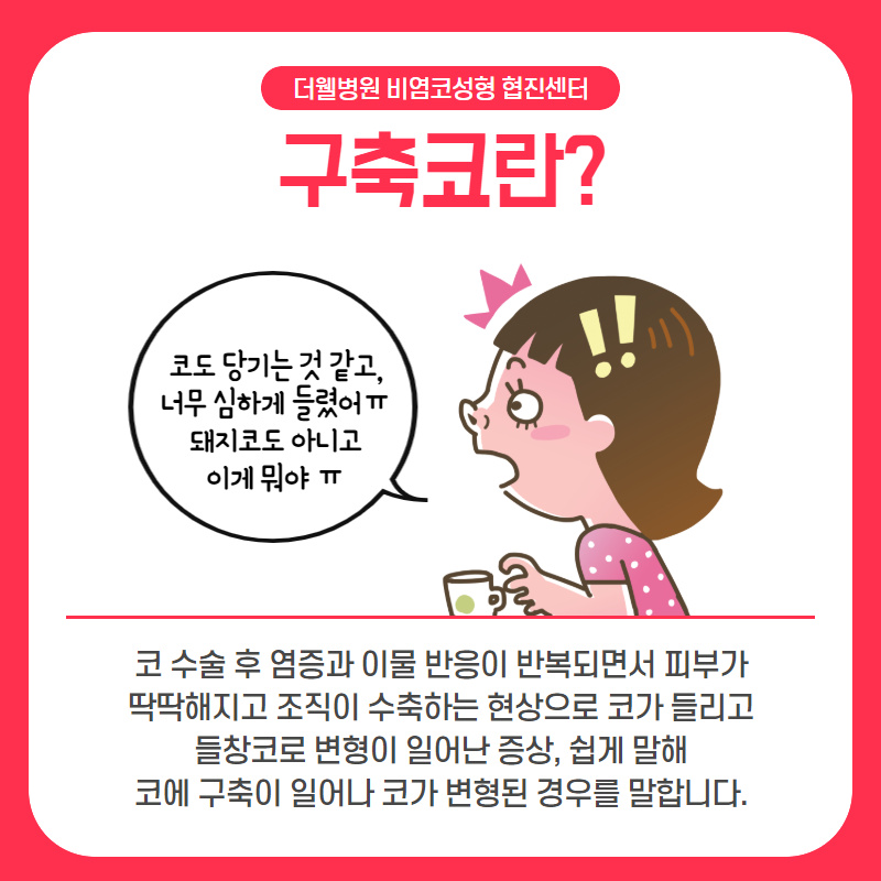 "코 재수술" 처음보다 더 꼼꼼하게 따져봐야해요! (3/10)