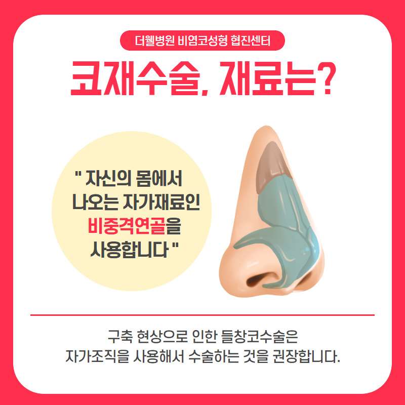 "코 재수술" 처음보다 더 꼼꼼하게 따져봐야해요! (4/10)