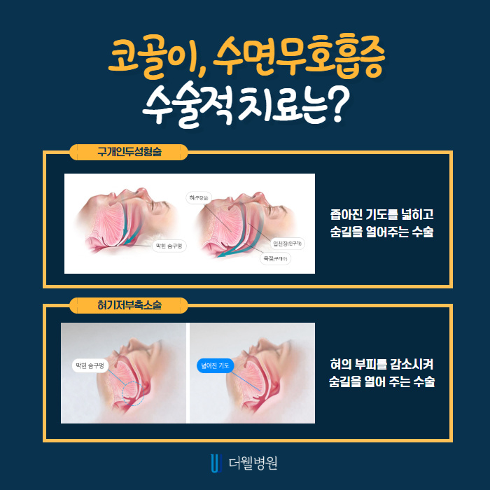 수면무호흡이 있으면 위험한가요? (5/10)