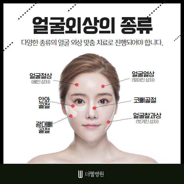 상처부터 골절까지 얼굴외상 치료! (3/10)
