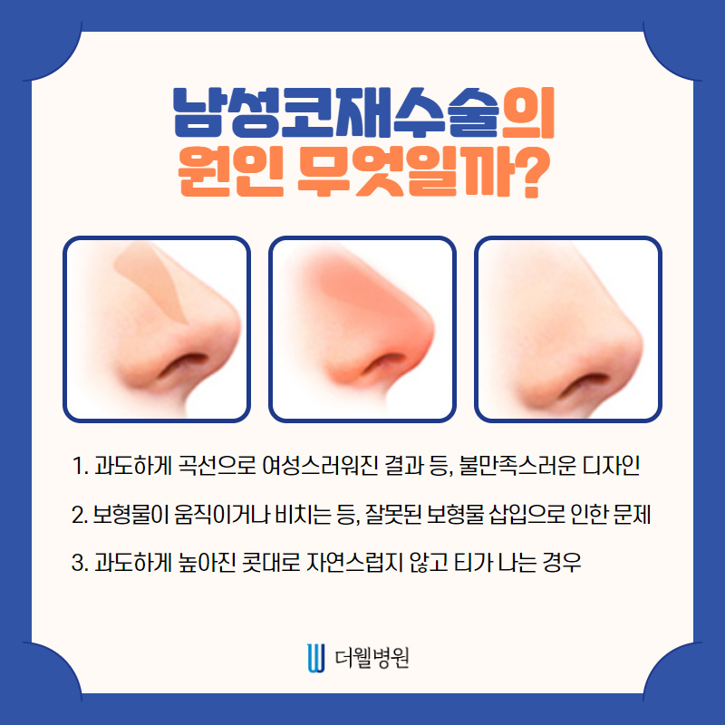 남성코재수술 첫수술보다 신중하게!! (3/10)
