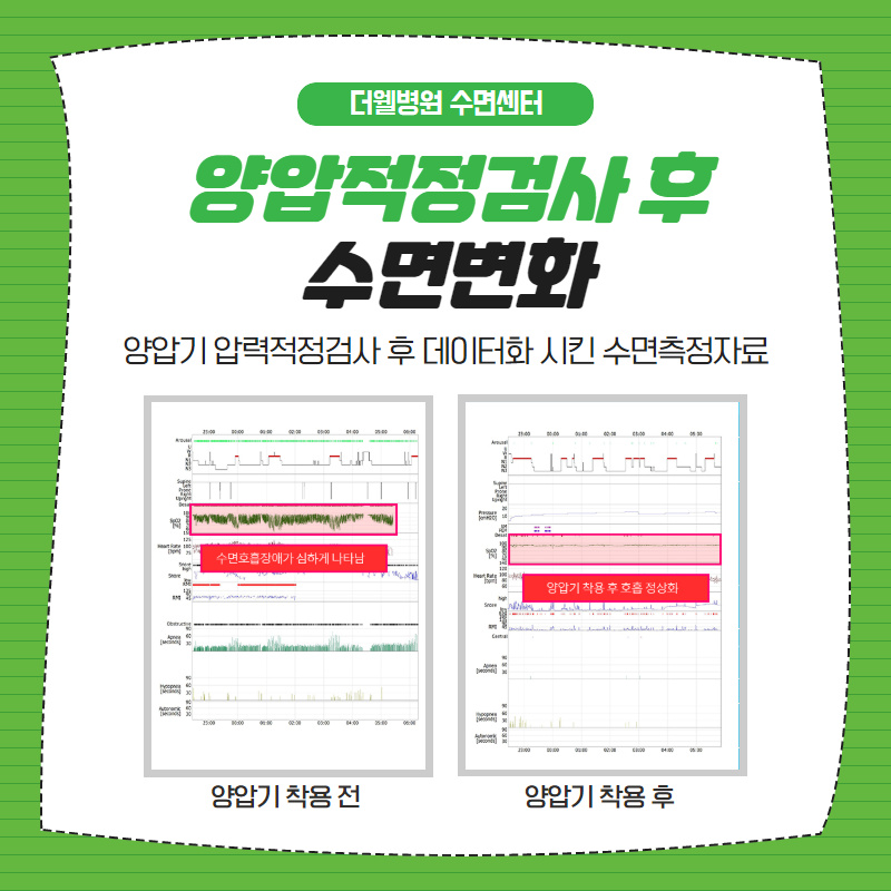 양압기 어떻게 써야하나요? (6/12)