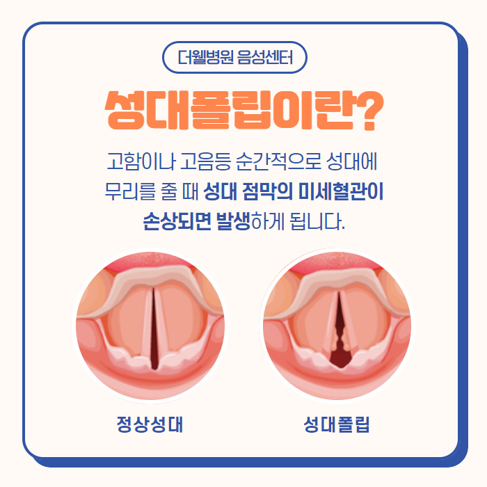 이물감에 쉰목소리....성대폴립?! (2/10)