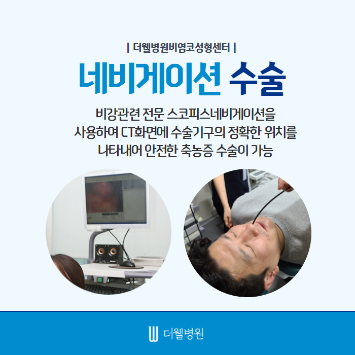 답답한 코막힘! 축농증일까?? (6/11)
