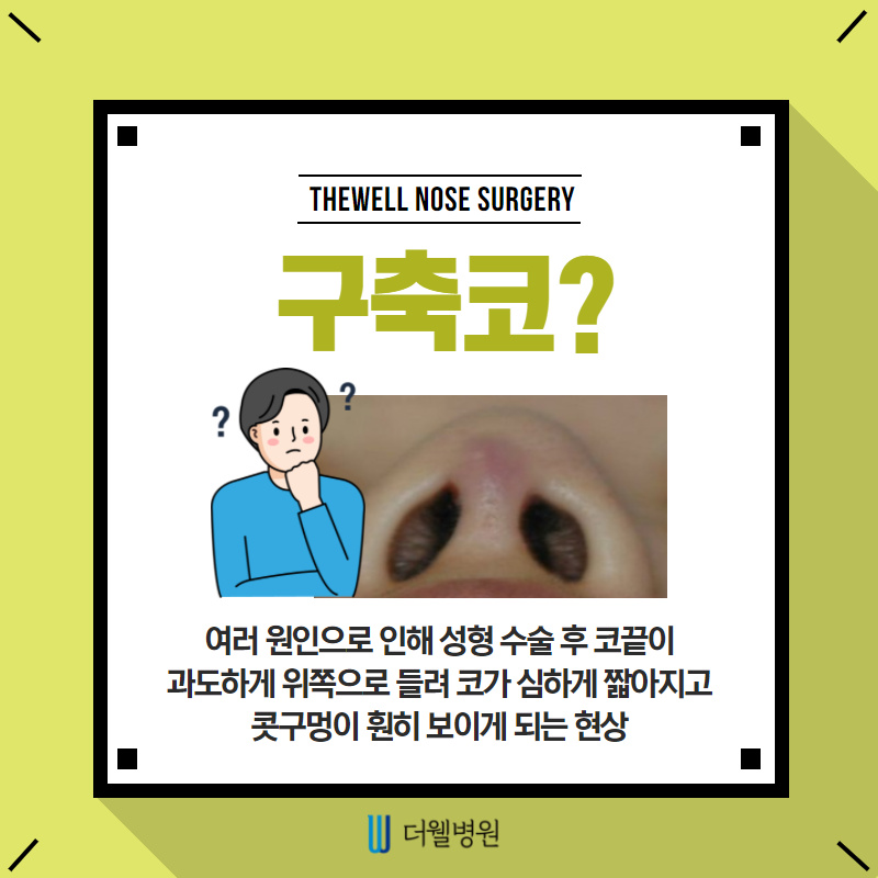 구축코 재수술 주의사항 확인하기! (2/10)