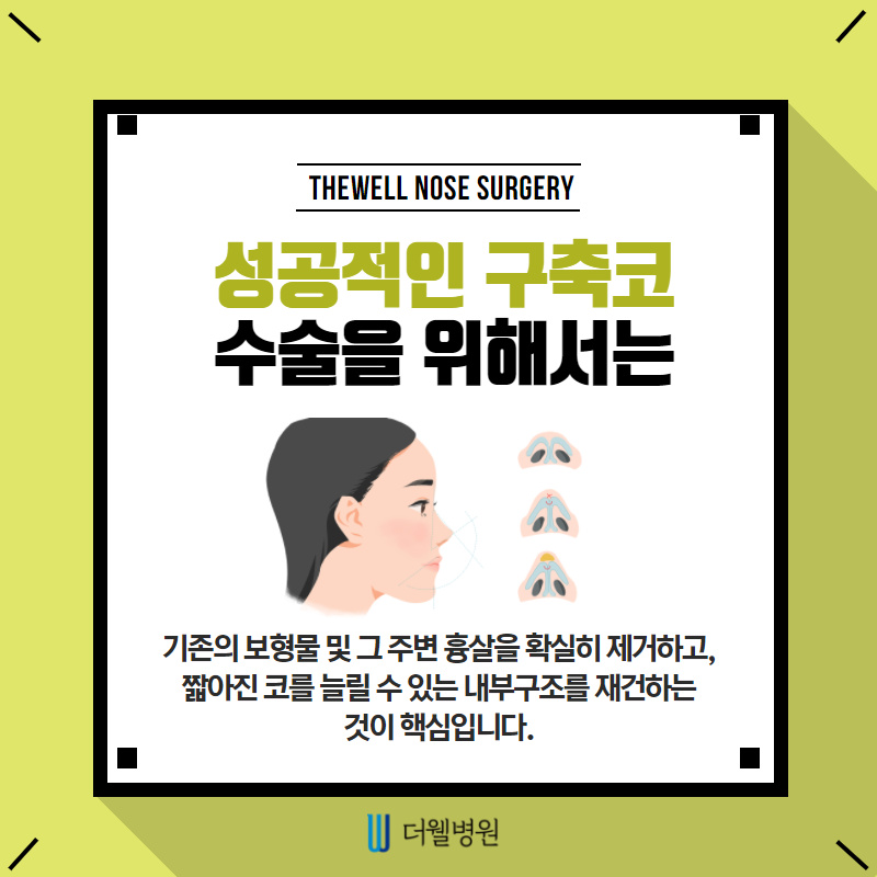 구축코 재수술 주의사항 확인하기! (5/10)