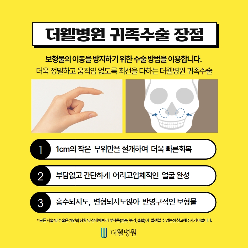더웰병원 귀족수술