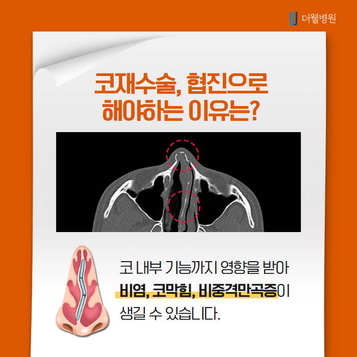 더웰병원 들창코·짧은코 교정