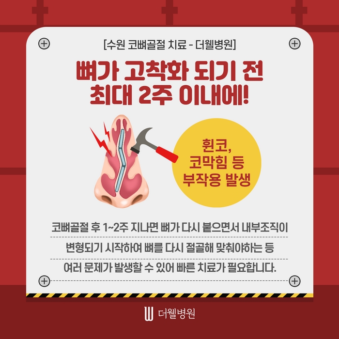더웰병원 코뼈골절 수술