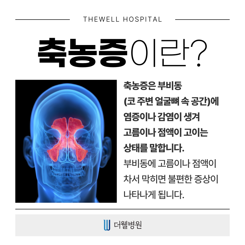 수원 기능코수술 _ 축농증 수술 이럴때 필요합니다! (2/12)