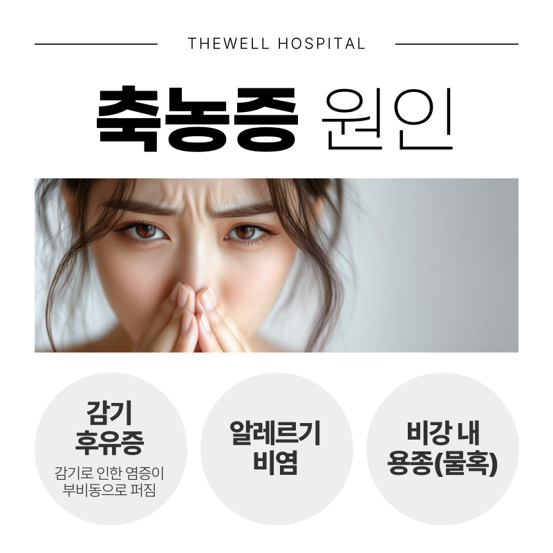 수원 기능코수술 _ 축농증 수술 이럴때 필요합니다! (4/12)