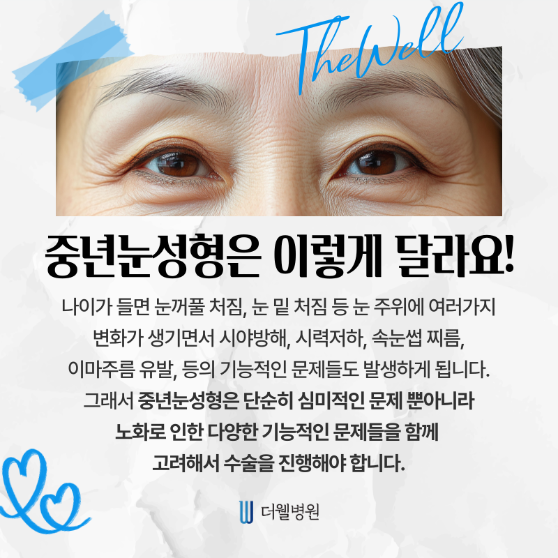 수원 성형외과 _ 중년 눈성형은 어떻게 다른가요? 수술 방법과 특징은? (2/7)