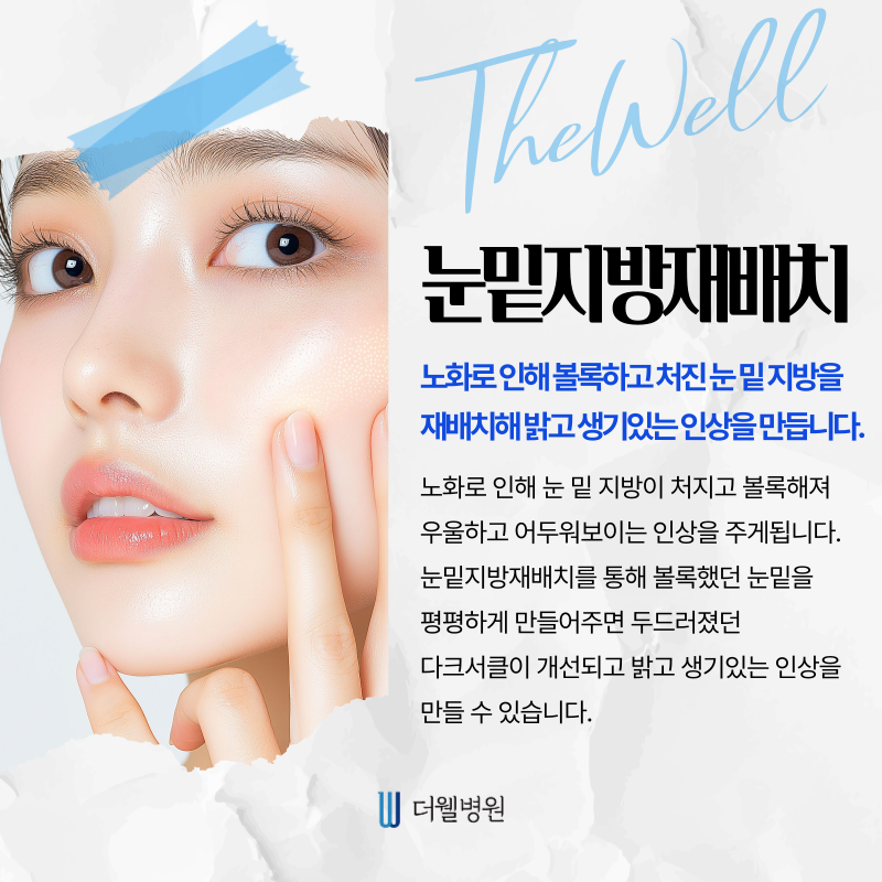 수원 성형외과 _ 중년 눈성형은 어떻게 다른가요? 수술 방법과 특징은? (4/7)